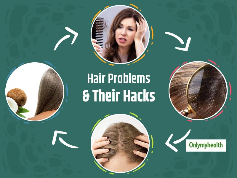 Natural Remedy for Grey Hairs Problem