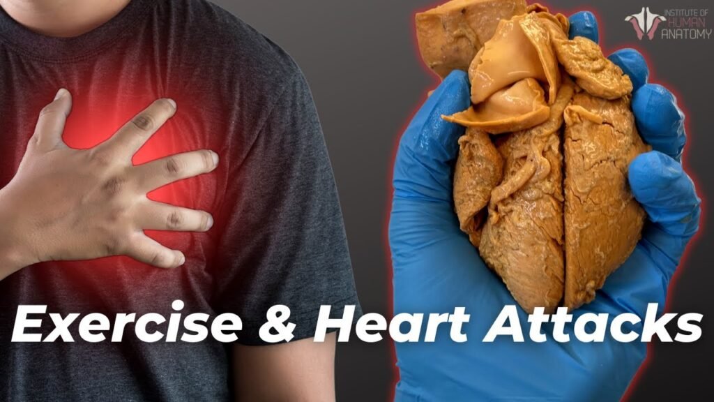 Heart Attack Reason During Exercise