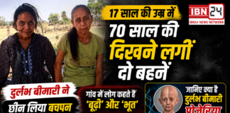 At 17, She Looks 70