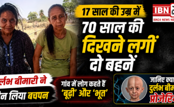At 17, She Looks 70